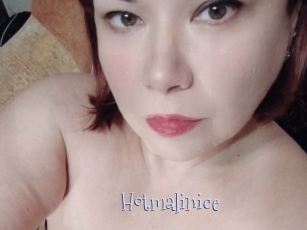 Hotmalinice