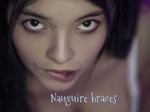 Nauguire_braces