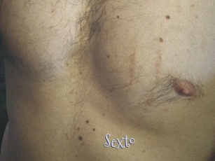 Sexto